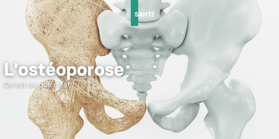 L'ostéoporose, qu'est ce que c'est?