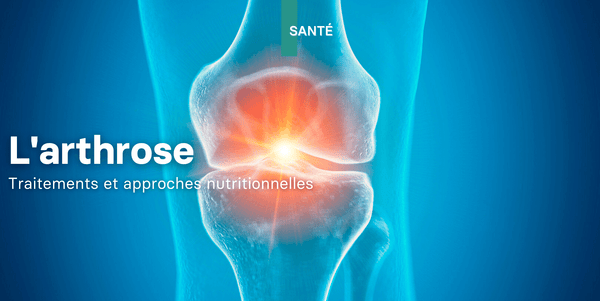 Les traitement de l'arthrose